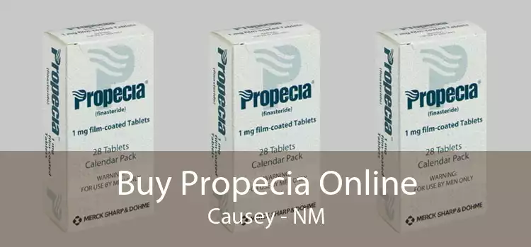 Buy Propecia Online Causey - NM
